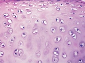 oa histology pic for page